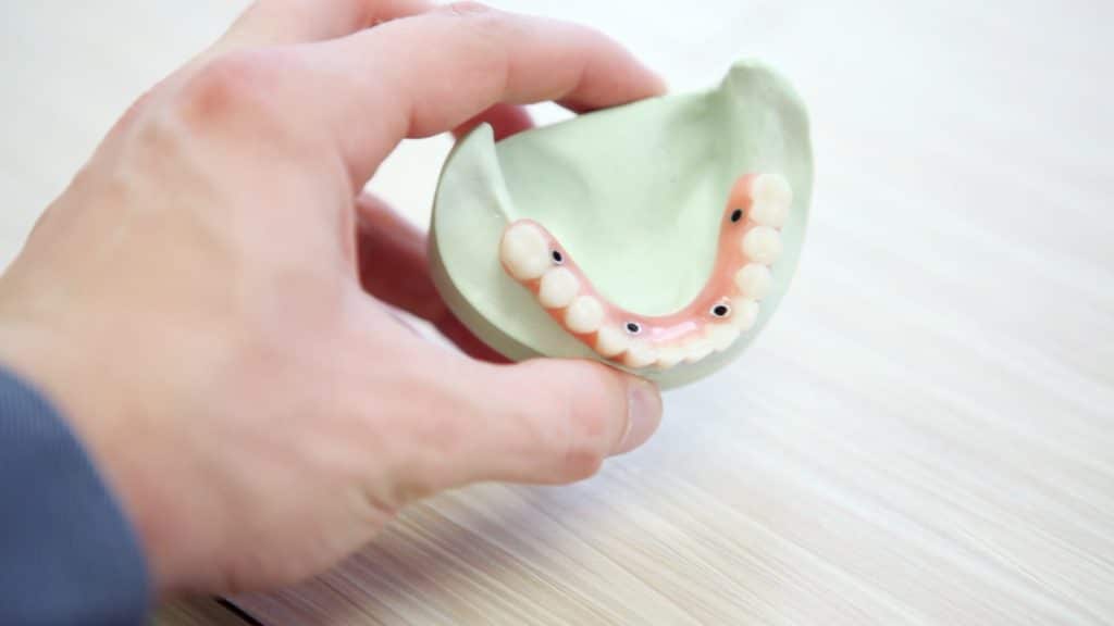 coolidge implant retained dentures